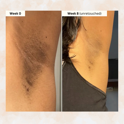 Kojic Acid Cleansing Pads