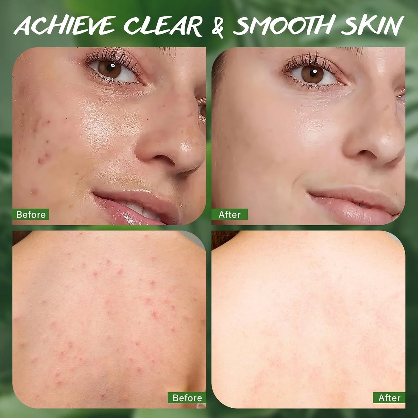 Tea Tree Oil – Antibacterial Soap