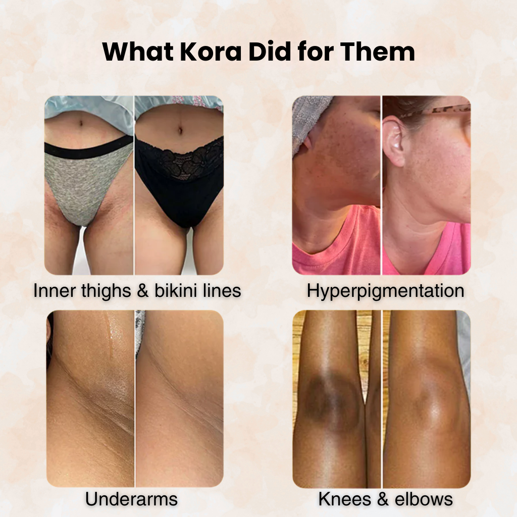Kojic Acid Cleansing Pads