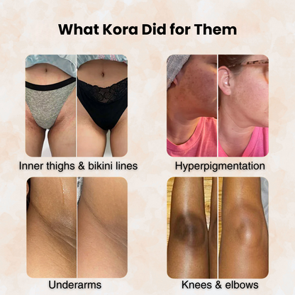 Kojic Acid Cleansing Pads