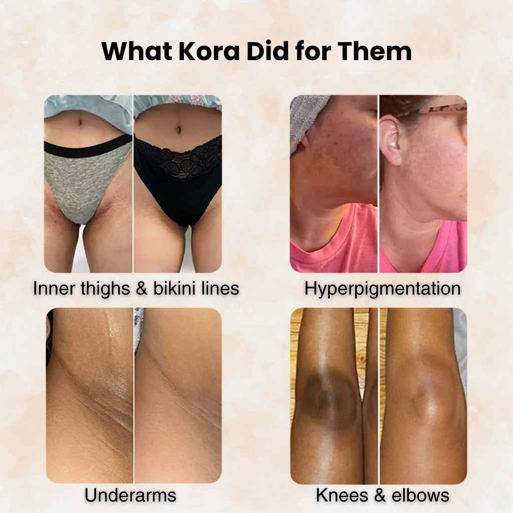 Turmeric & Kojic Acid - Brightening Soap