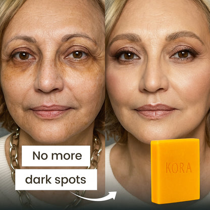 Turmeric & Kojic Acid - Skin Brightening Soap