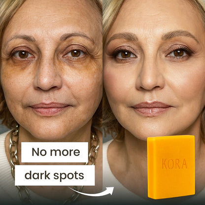 Turmeric & Kojic Acid - Brightening Soap